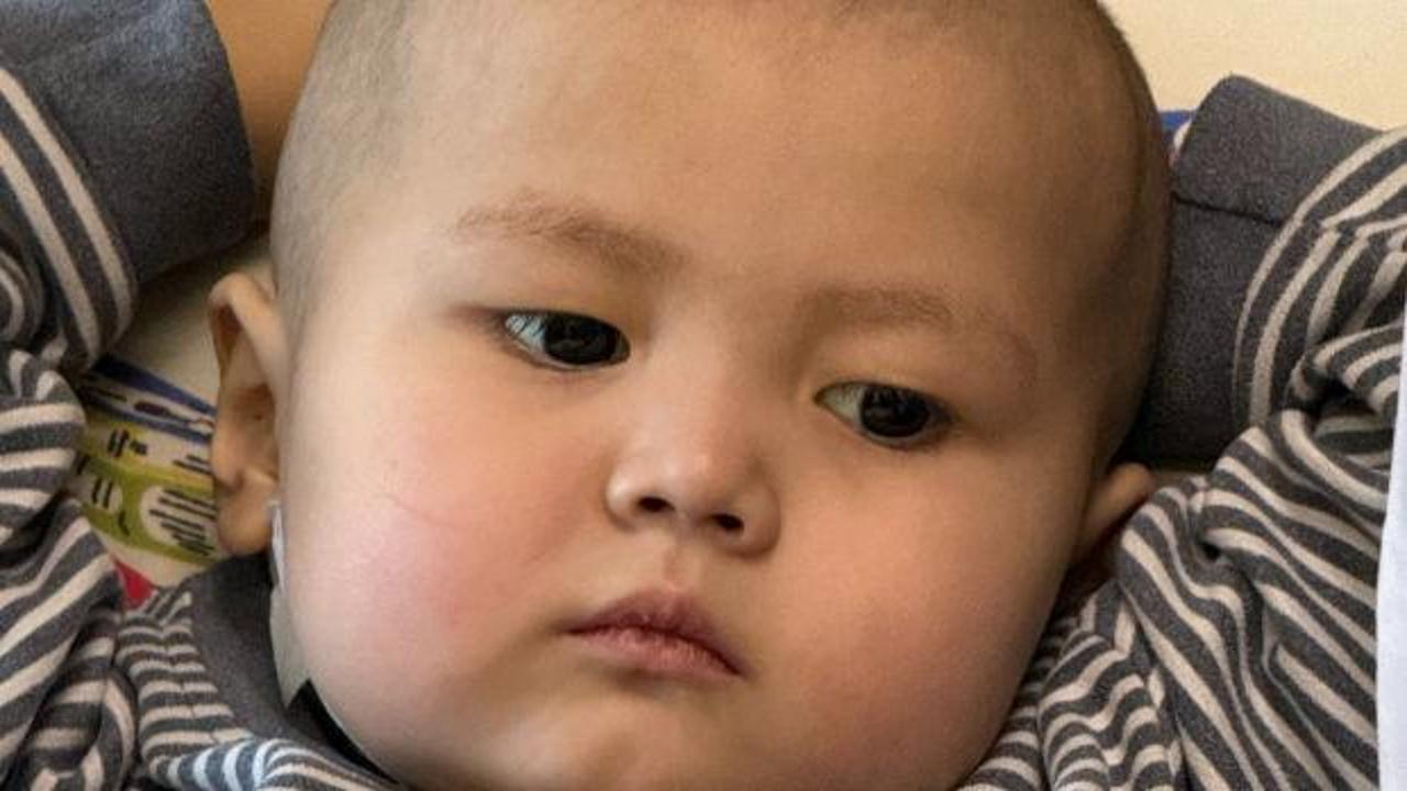 3 yaşındaki Nuryiğit, karaciğer nakliyle hayata tutundu